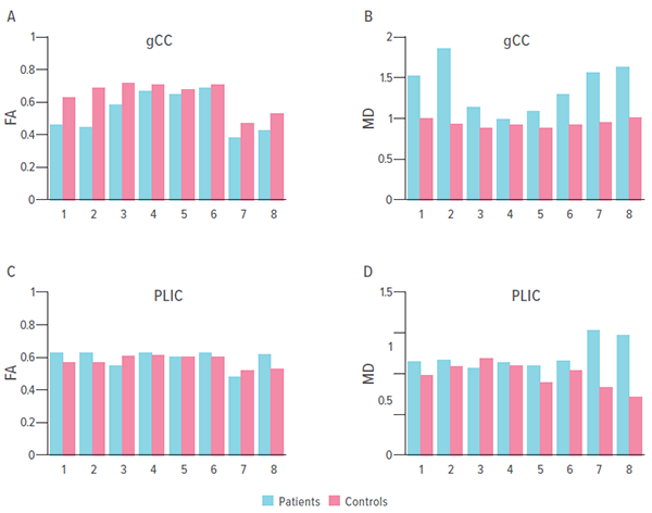 An image of bar charts.