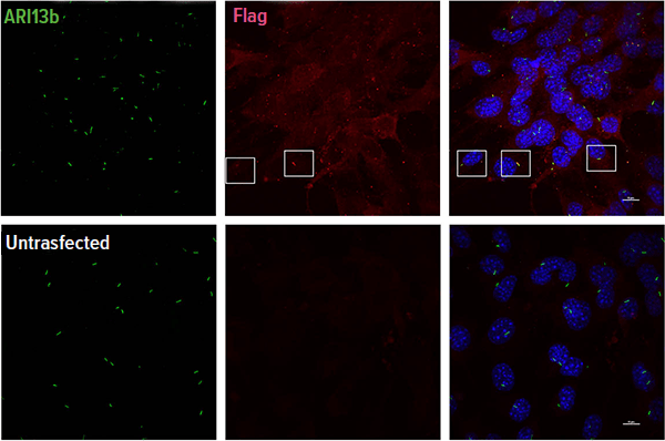 A confocal microscope image indicating GPR63 expression with ciliary localization.