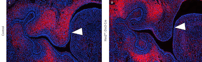 An image showing the result of loss of hyaluronic acid accumulation in the palatal mesenchyme in Has2f/f;Osr2-Cre mutant embryos compared to control.