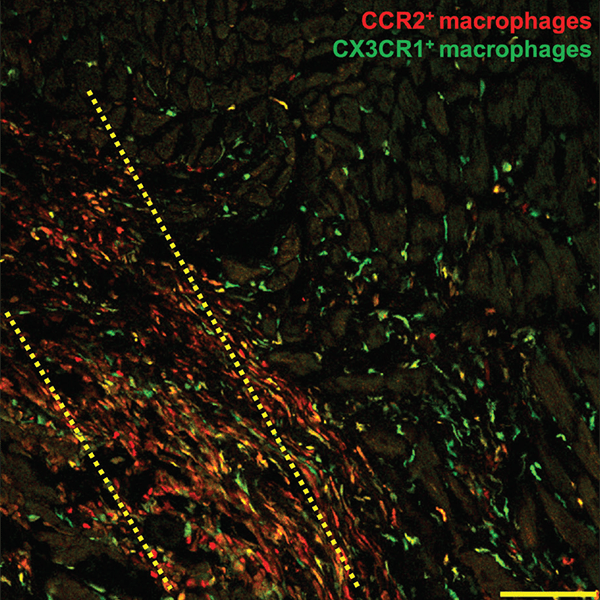A microscopic histology image showing how macrophage immune cells flock to the injured region of a damaged mouse heart.
