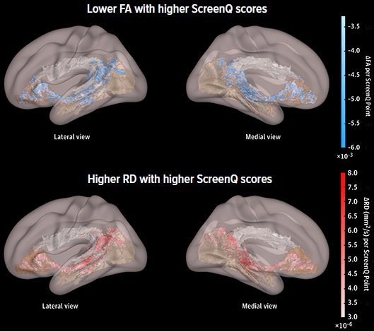 An image showing diffusion tensor MRI imaging results.
