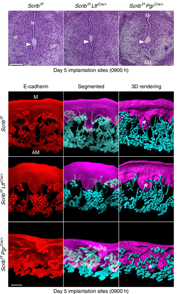 Panels showing how implantation goes wrong without the involvement of the Scrib protein in stromal cells.