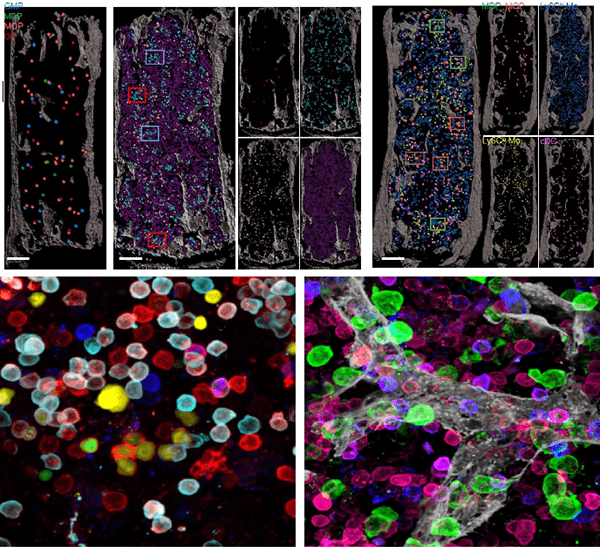 Images related to blood cell production in bone marrow.