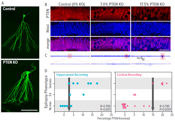 Images related to epilepsy research.