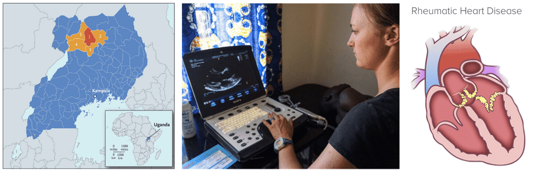 A map of Uganda, a woman using a computer, and a graphic of a human heart.