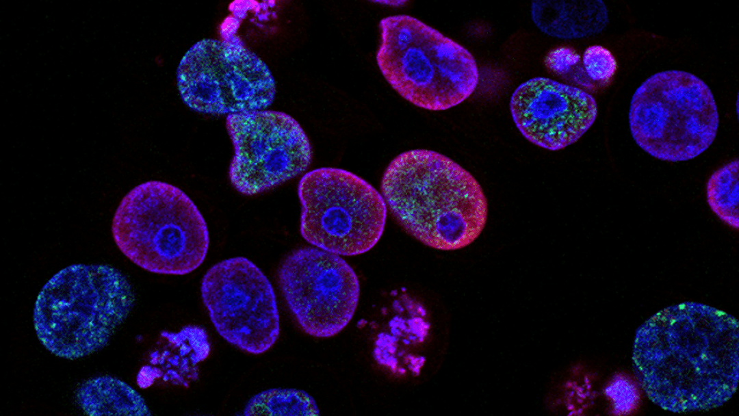 Image taken through a microscope.