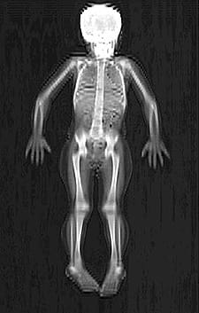 body scan