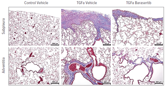 Representative images of Masson’s trichrome-stained lung sections from the vehicle- and barasertib-treated mice.
