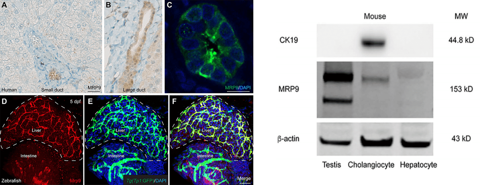 Chromogenic detection of MRP9 protein in the control liver of a child without known liver disease.