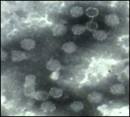 HPV Surveillance Studies.