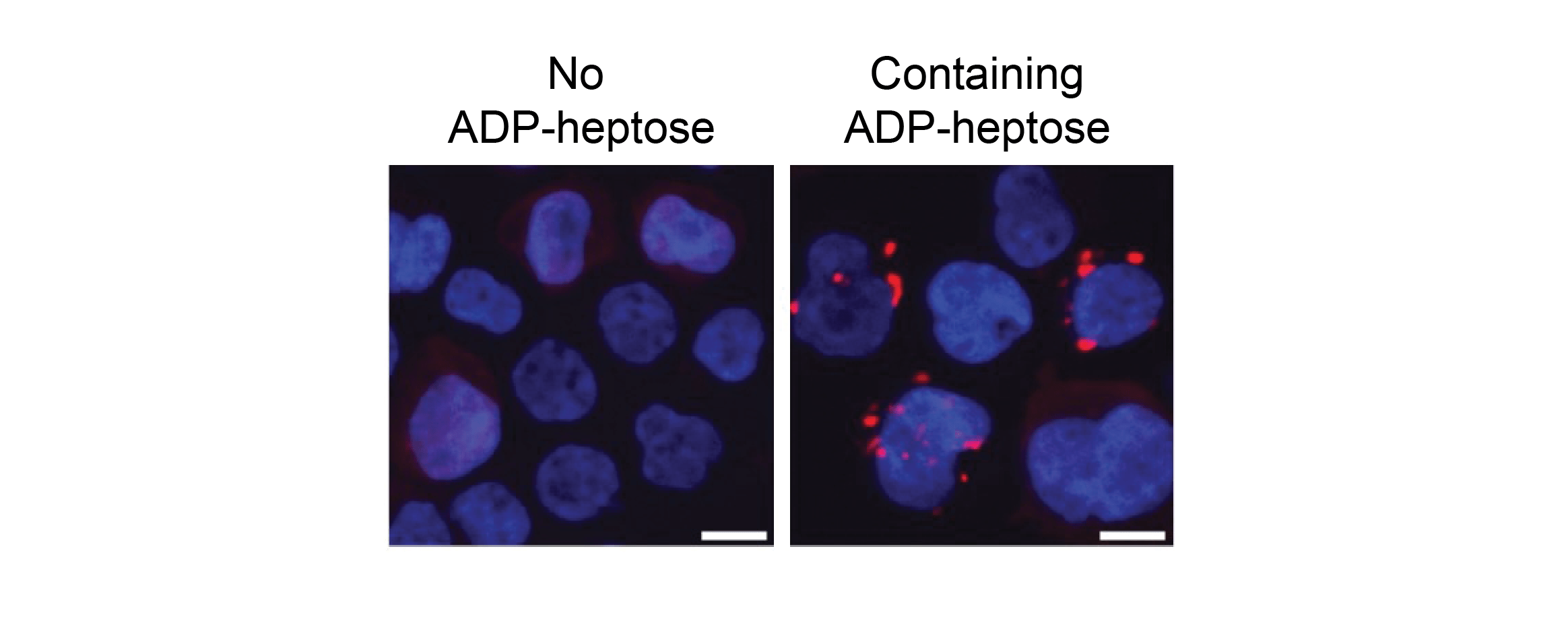 TIFAsomes in leukemic cells after ADP-heptose exposure.