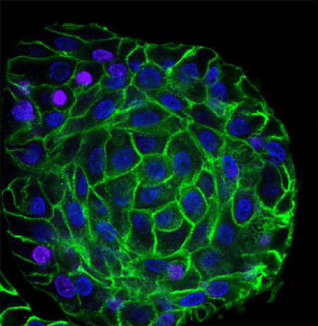 Image of an esophageal cell spheroid from organoid culture stained for E cadherin (green), Ki67 (red), and DNA (blue).
