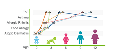 A graph showing the prevalence of eosinophilic esophagitis (EoE).