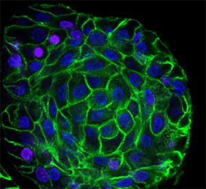A simplified air-liquid interface (ALI) culture system to study differentiated squamous epithelia in vitro.