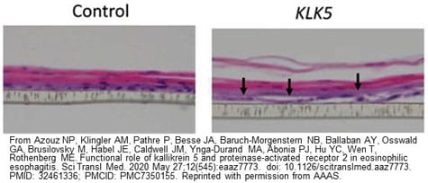 Fluorescent microscopy of esophageal sections from mice that were injected with fluorescent alpha 1 anti-trypsin (A1AT, cyan), a protease inhibitor.