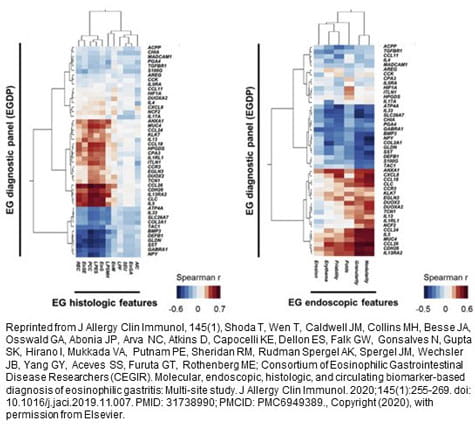 Tissue-based Molecular Panel in Eosinophilic Gastritis.