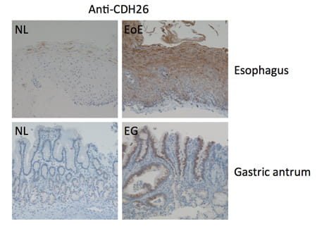 Cadherin-like 26 in EGID image.
