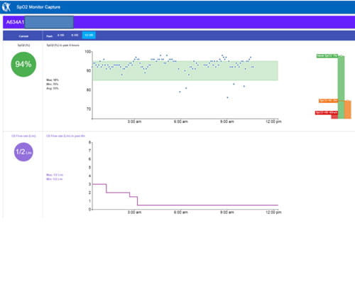 Image from the spO2 visualization project.