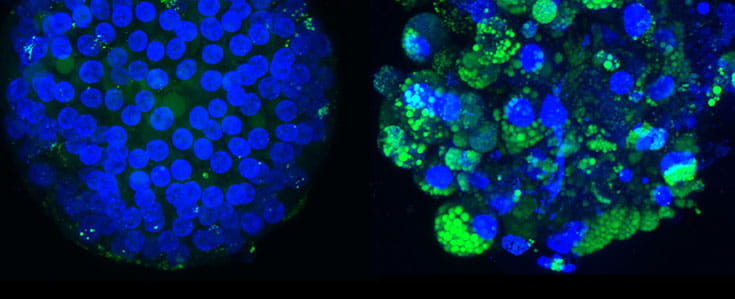 Toxicity Screening and organoids