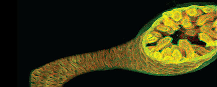 First colon grown in dish.