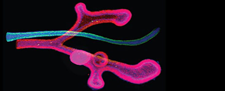 Origins of trachea-esophageal birth defects