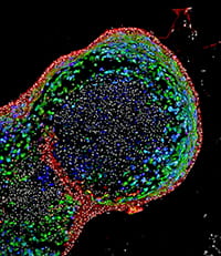 esophagus from stem cells