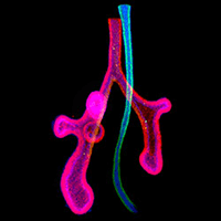 trachea defects