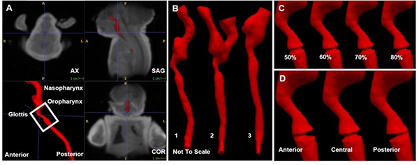 An image showing 3D reconstruction and modification of non-pathologic airways.