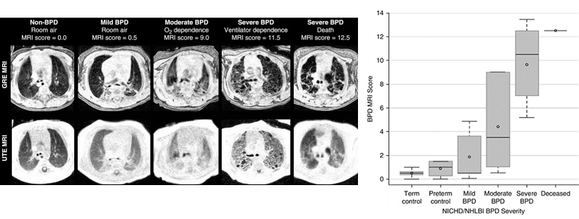 A photo of imaging research on BPD.
