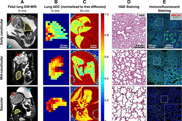 A photo of scientific images related to BPD.