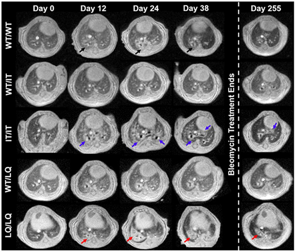 An image showing a longitudinal MRI of SP-C mutant mice.