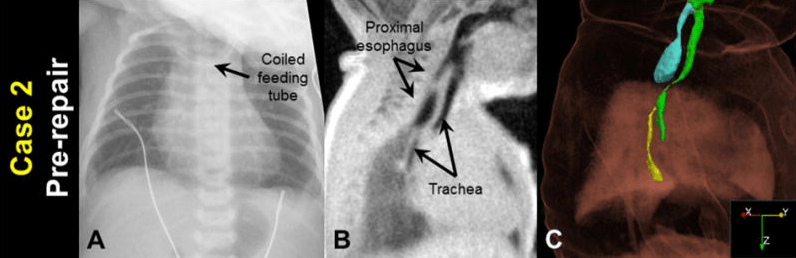 A photo of images related to neonatal and infant imaging research.