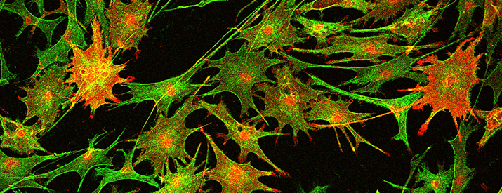An image of Schwann cells and myelin proteins.