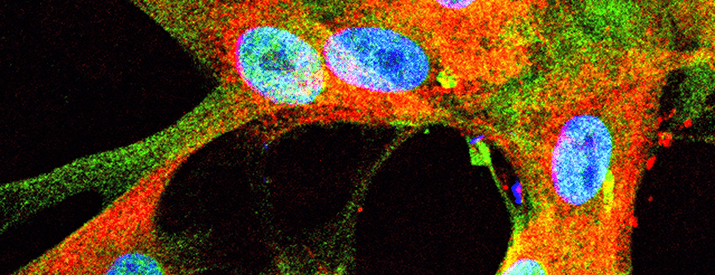 An image highlighting TAZ/YAP in human nerve tumors.