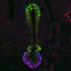 pancreas and biliary development