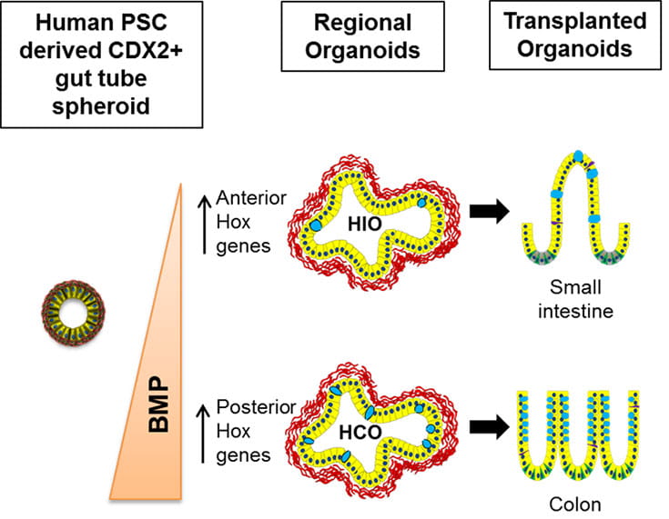 Differentiation of hPSC to Colonic Tissue