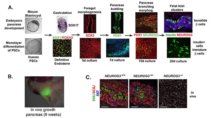 pancreatic differentiation