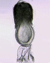 Endoderm development.