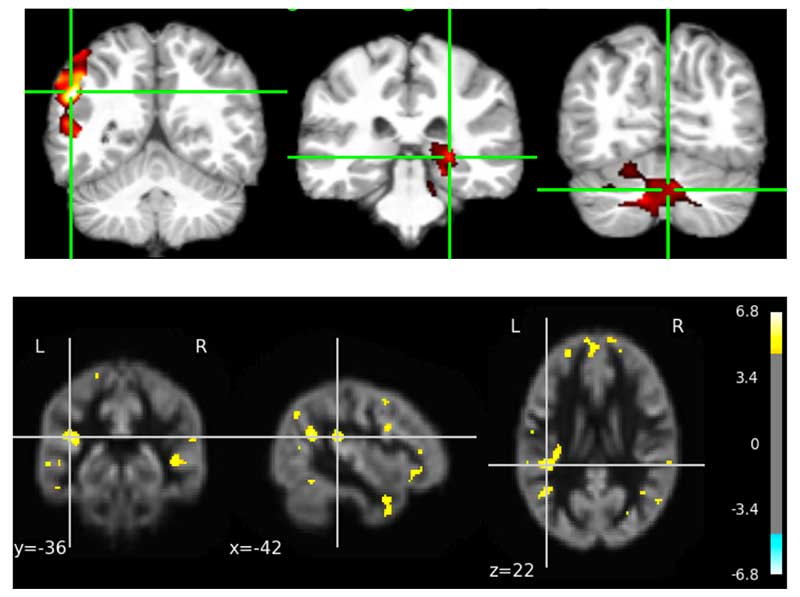 An image of the brain.