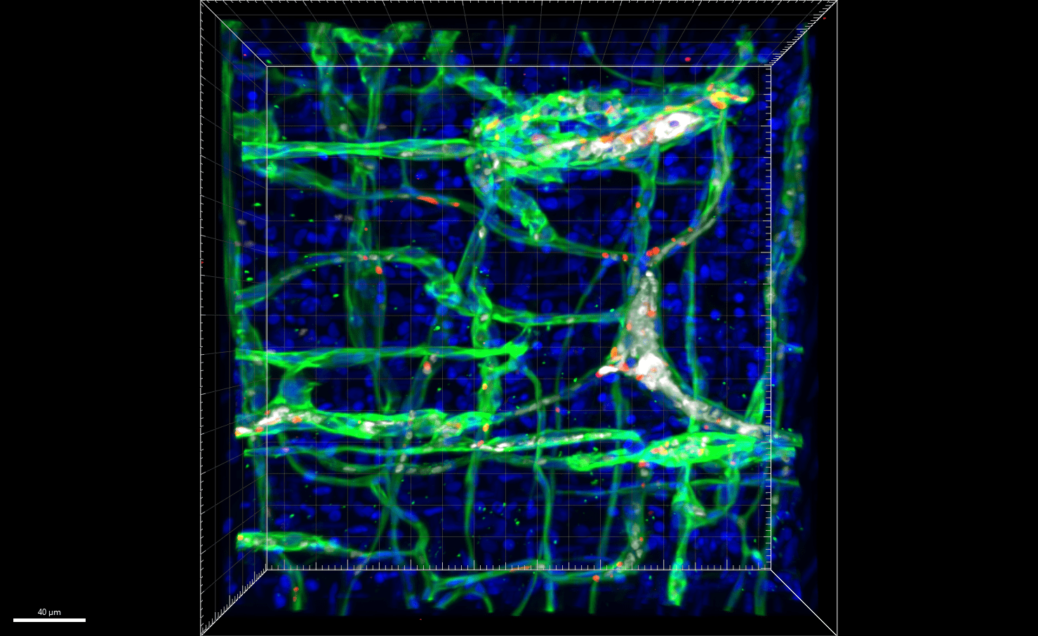 This 3D image reconstruction shows the distorted vascular structure (green) of a mouse expressing mutant GNAQ.
