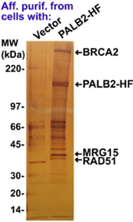 Silver-stained gel identifying MRG15 as a PALB2-interacting protein.