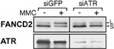ATR is required for MMC-induced monoubiquitination of FANCD2.