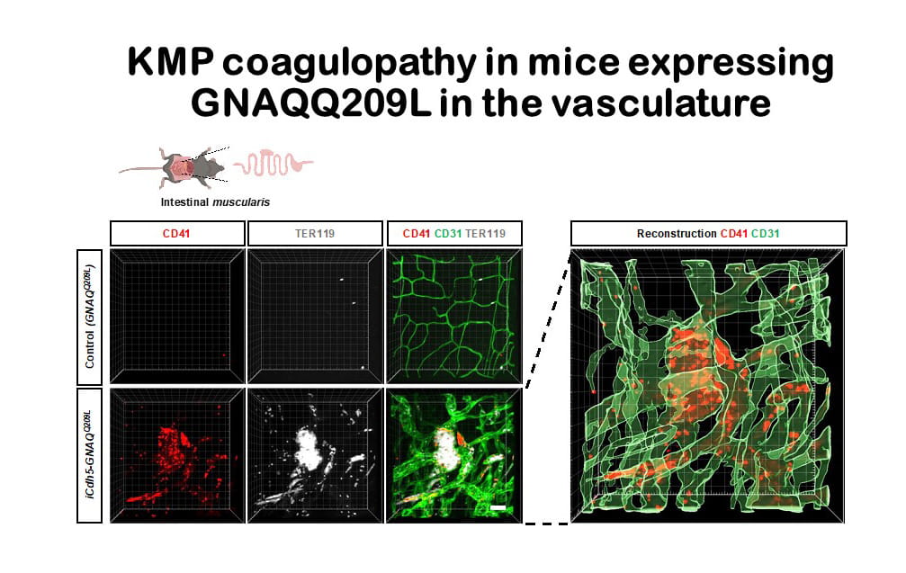 KMP coagulopathy in mice expressing GNAQQ209L in the vasculature.