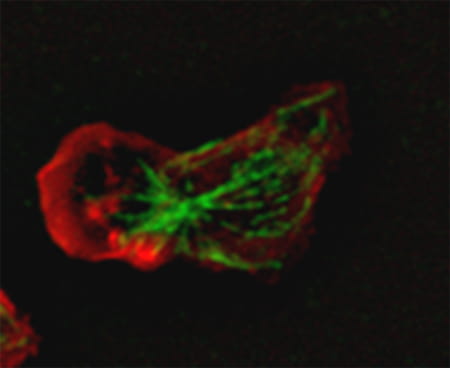Neutrophil cytoskeleton organization.