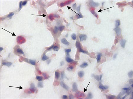 Lung histology esterase staining.