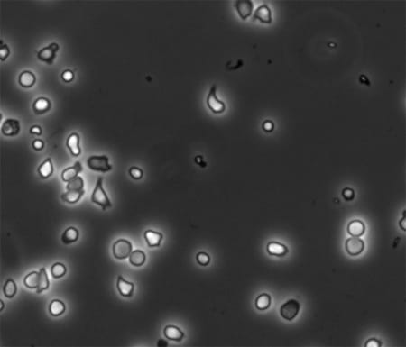 Neutrophil migration.
