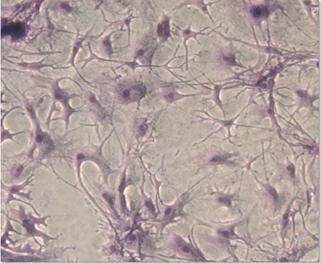 CFU-Fibroblasts.