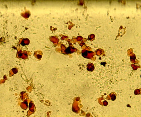 CFU adipocytes.