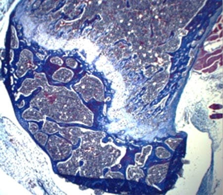 Bone Trichrome Masson staining.