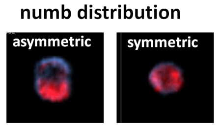 Numb Distribution.